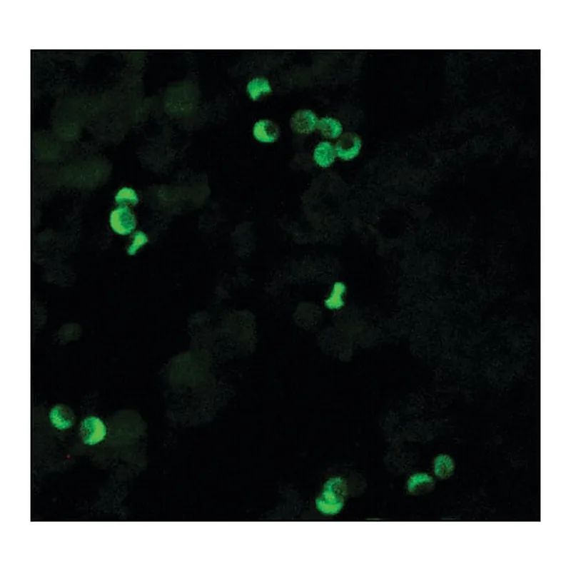Merck Monoclonal Anti-HLA Class I Antigen antibody produced in mouse