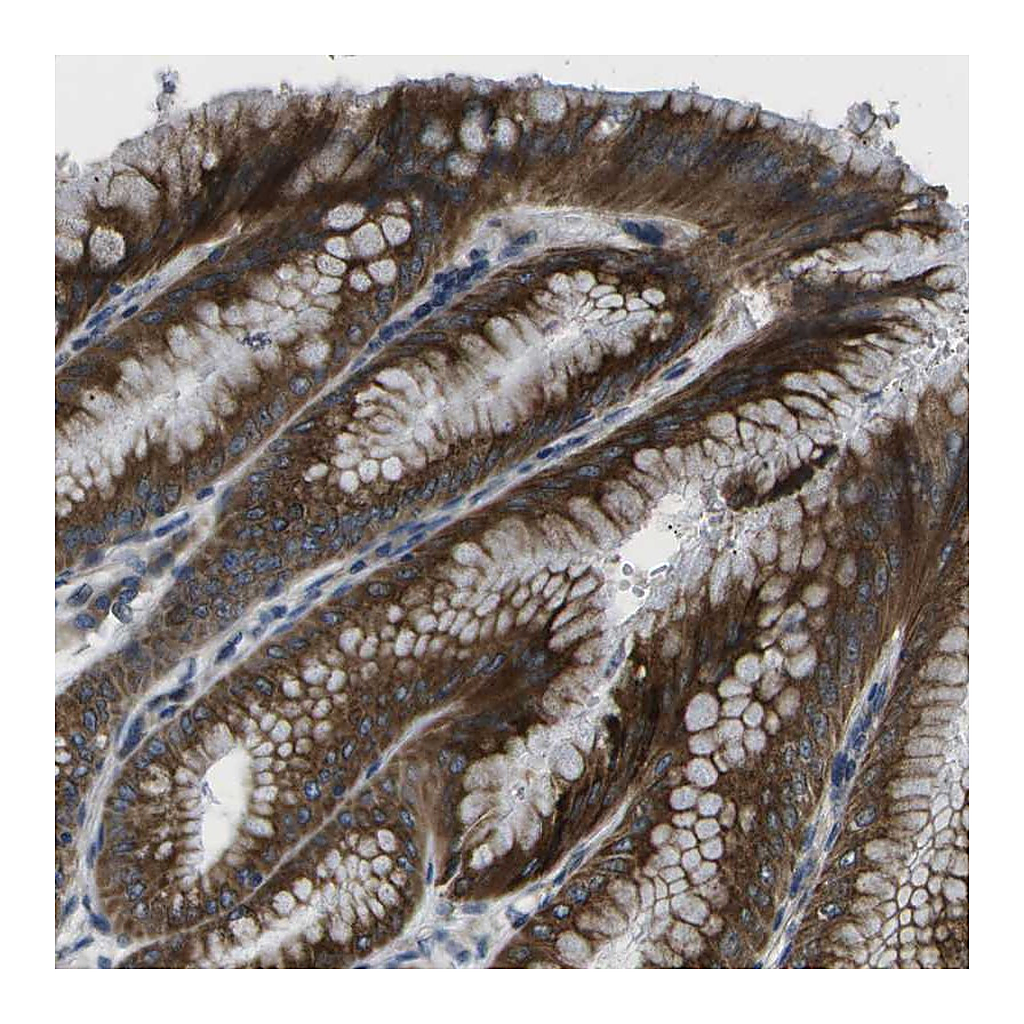 Atlas Antibodies Anti-GDF5 Antibody