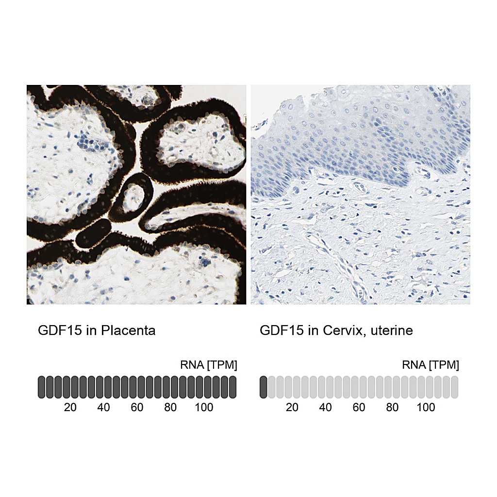 Atlas Antibodies Anti-GDF15 Antibody