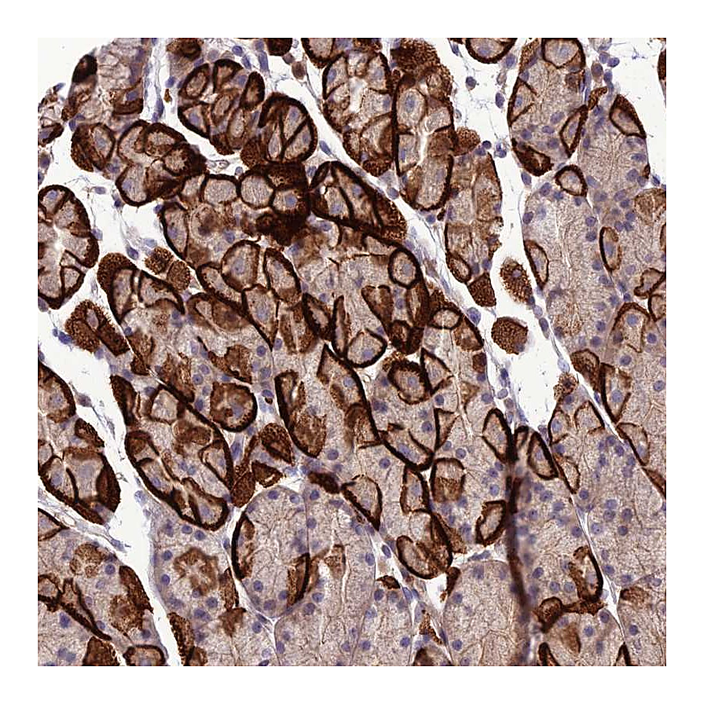 Atlas Antibodies Anti-GDF6 Antibody