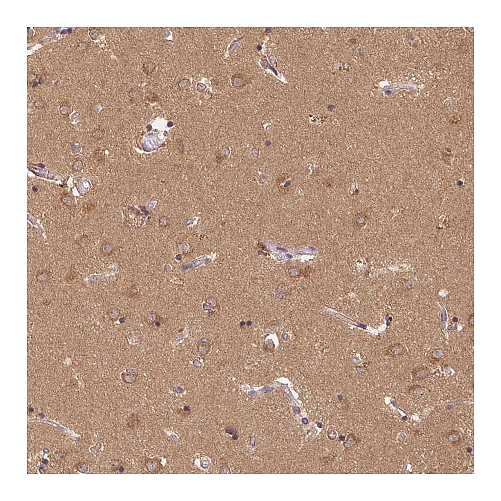 Atlas Antibodies Anti-GDI1 Antibody