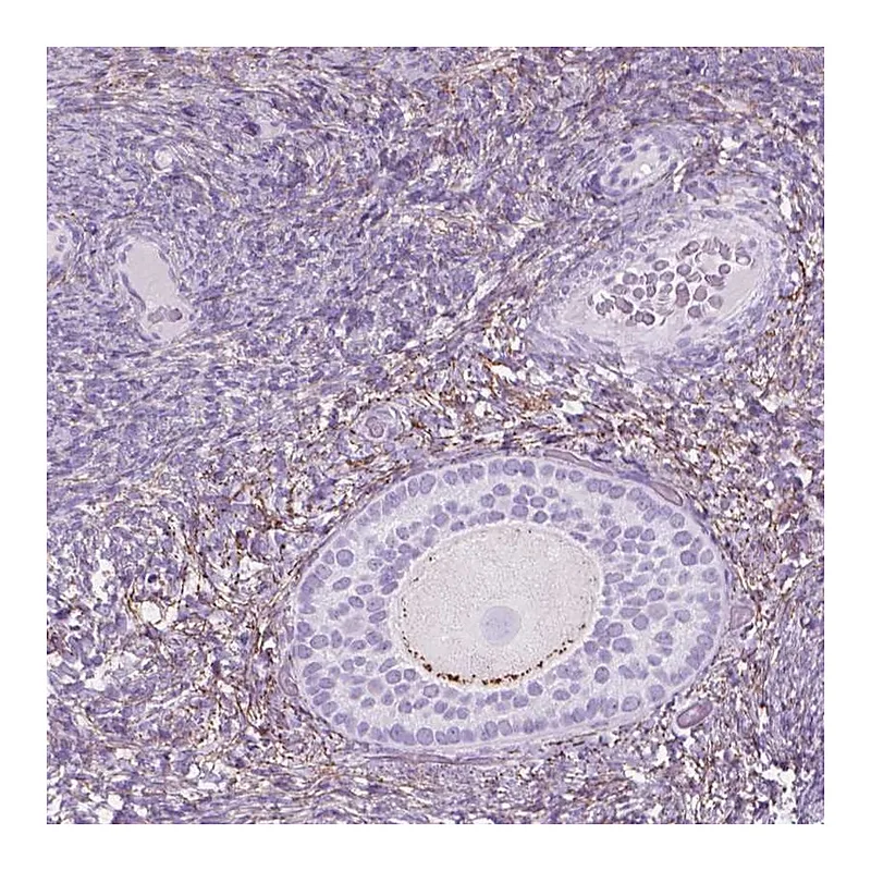 Atlas Antibodies Anti-GDF9 Antibody