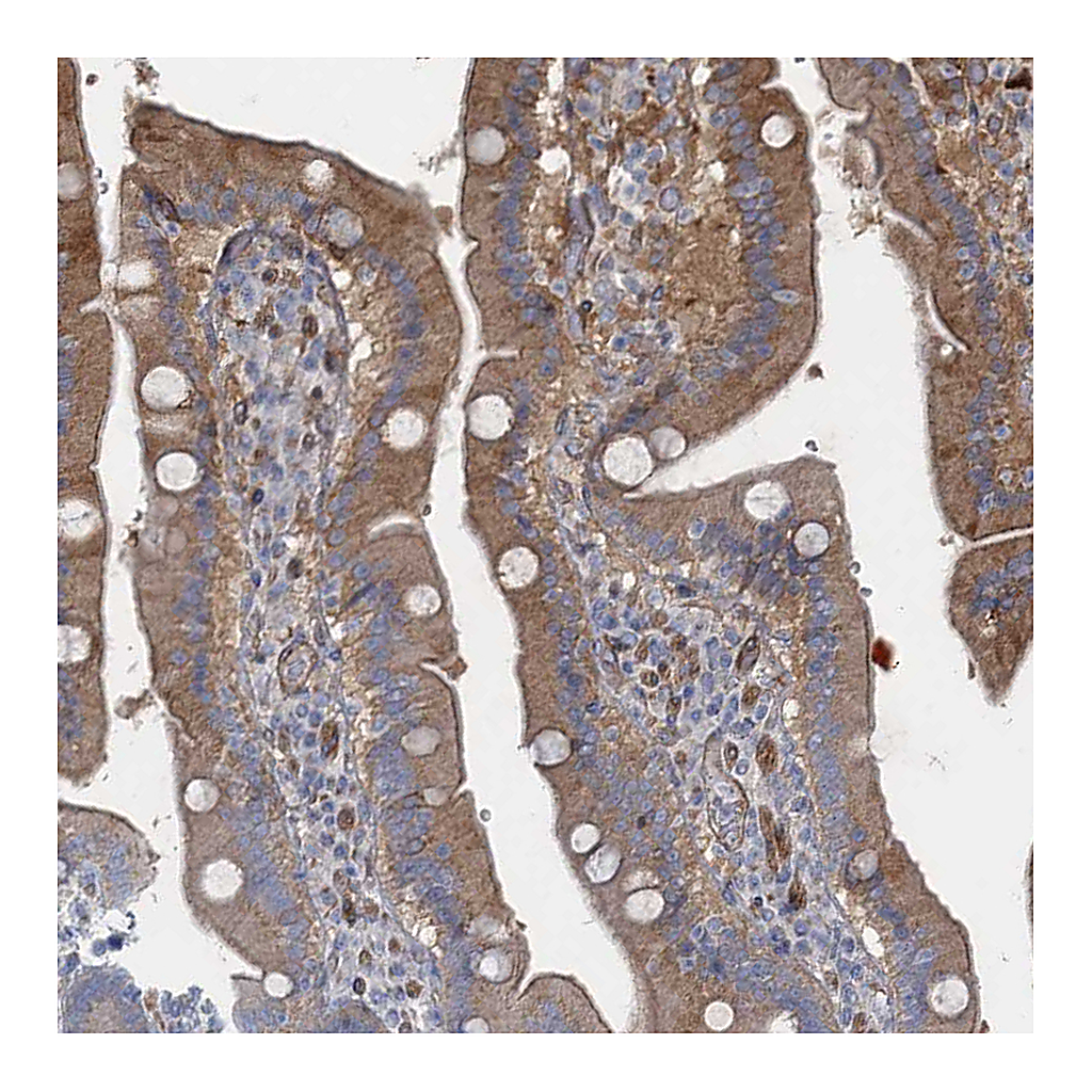Atlas Antibodies Anti-GDPD3 Antibody