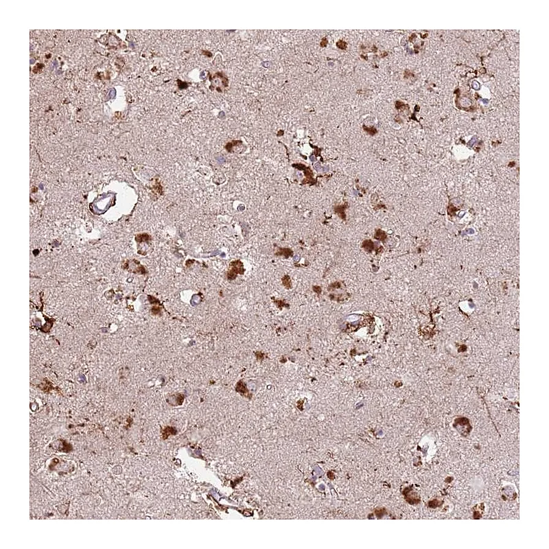 Atlas Antibodies Anti-GDPGP1 Antibody