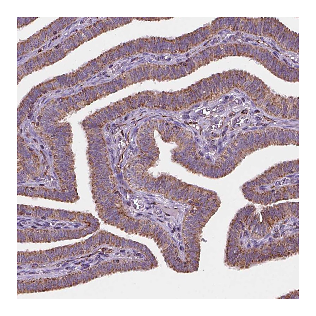 Atlas Antibodies Anti-GEMIN4 Antibody