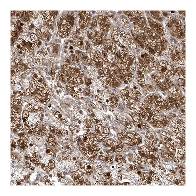 Atlas Antibodies Anti-GEMIN6 Antibody