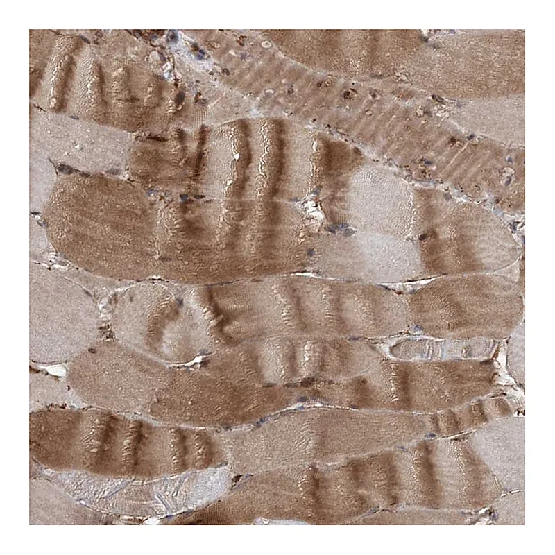 Atlas Antibodies Anti-GEMIN5 Antibody