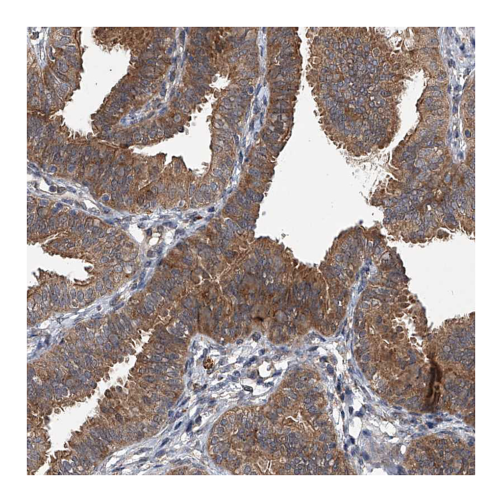Atlas Antibodies Anti-GEMIN8 Antibody