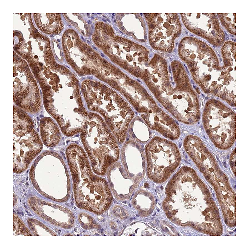 Atlas Antibodies Anti-GEN1 Antibody