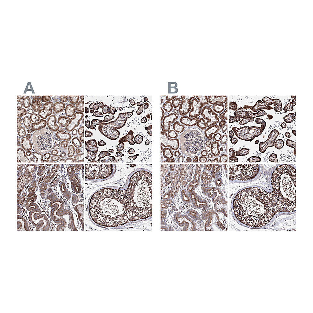 Atlas Antibodies Anti-GFM1 Antibody