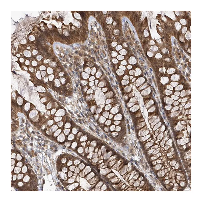 Atlas Antibodies Anti-GFM2 Antibody