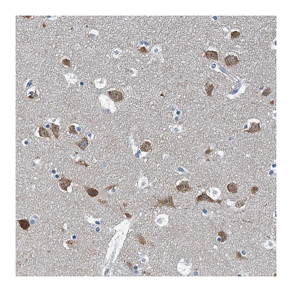 Atlas Antibodies Anti-GFOD2 Antibody