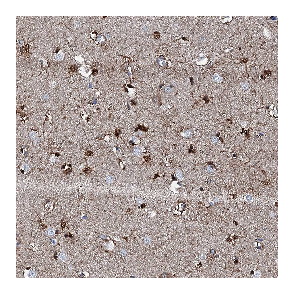 Atlas Antibodies Anti-GFOD2 Antibody