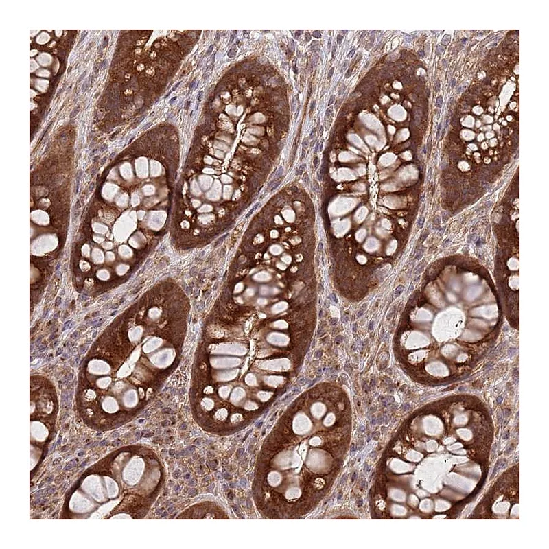 Atlas Antibodies Anti-GGA1 Antibody