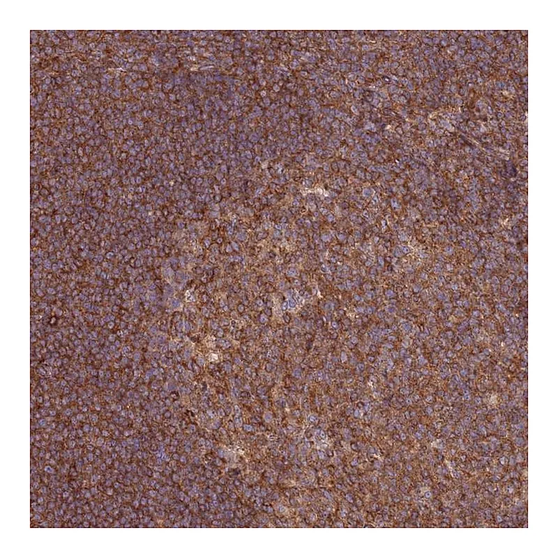 Atlas Antibodies Anti-GGA1 Antibody