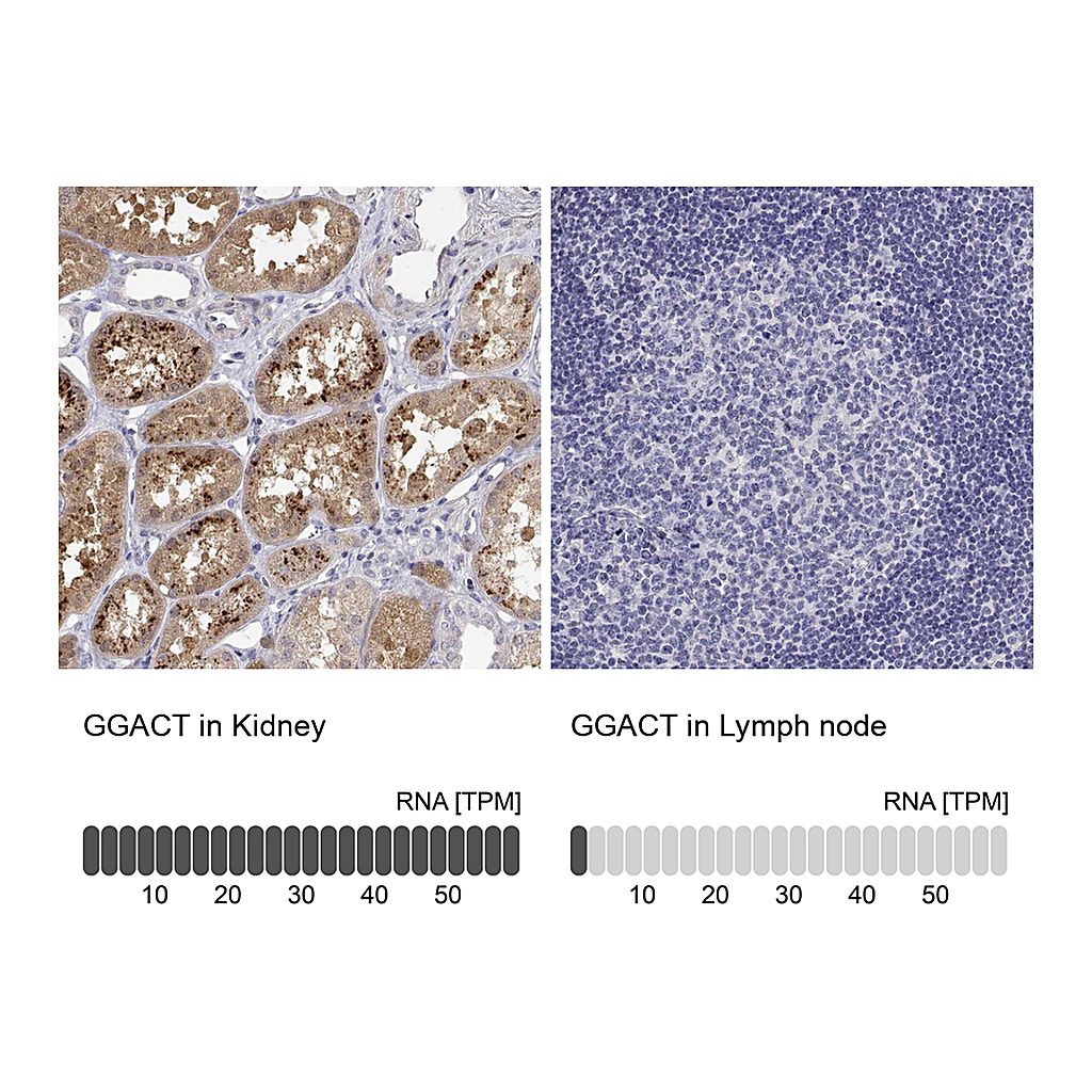 Atlas Antibodies Anti-GGACT Antibody