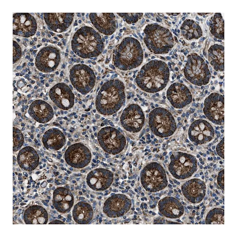 Atlas Antibodies Anti-GGCT Antibody