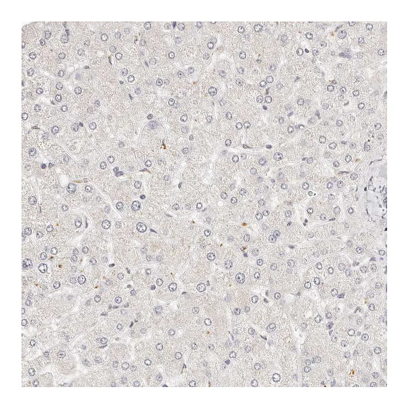 Atlas Antibodies Anti-GGPS1 Antibody