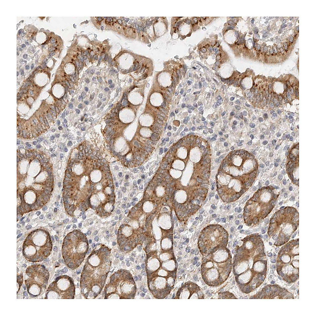Atlas Antibodies Anti-GGT6 Antibody