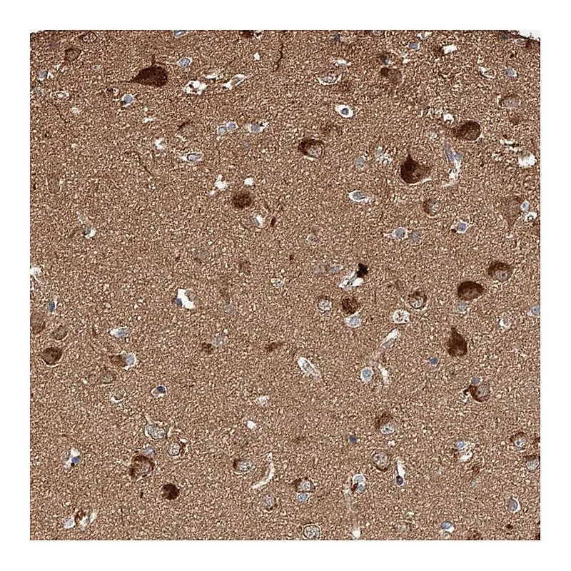 Atlas Antibodies Anti-GHDC Antibody