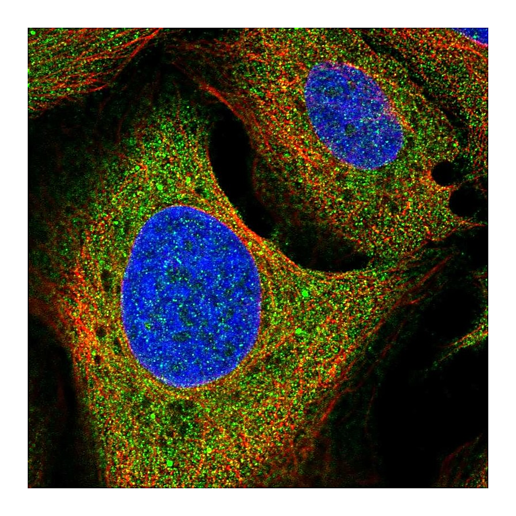 Atlas Antibodies Anti-GHR Antibody