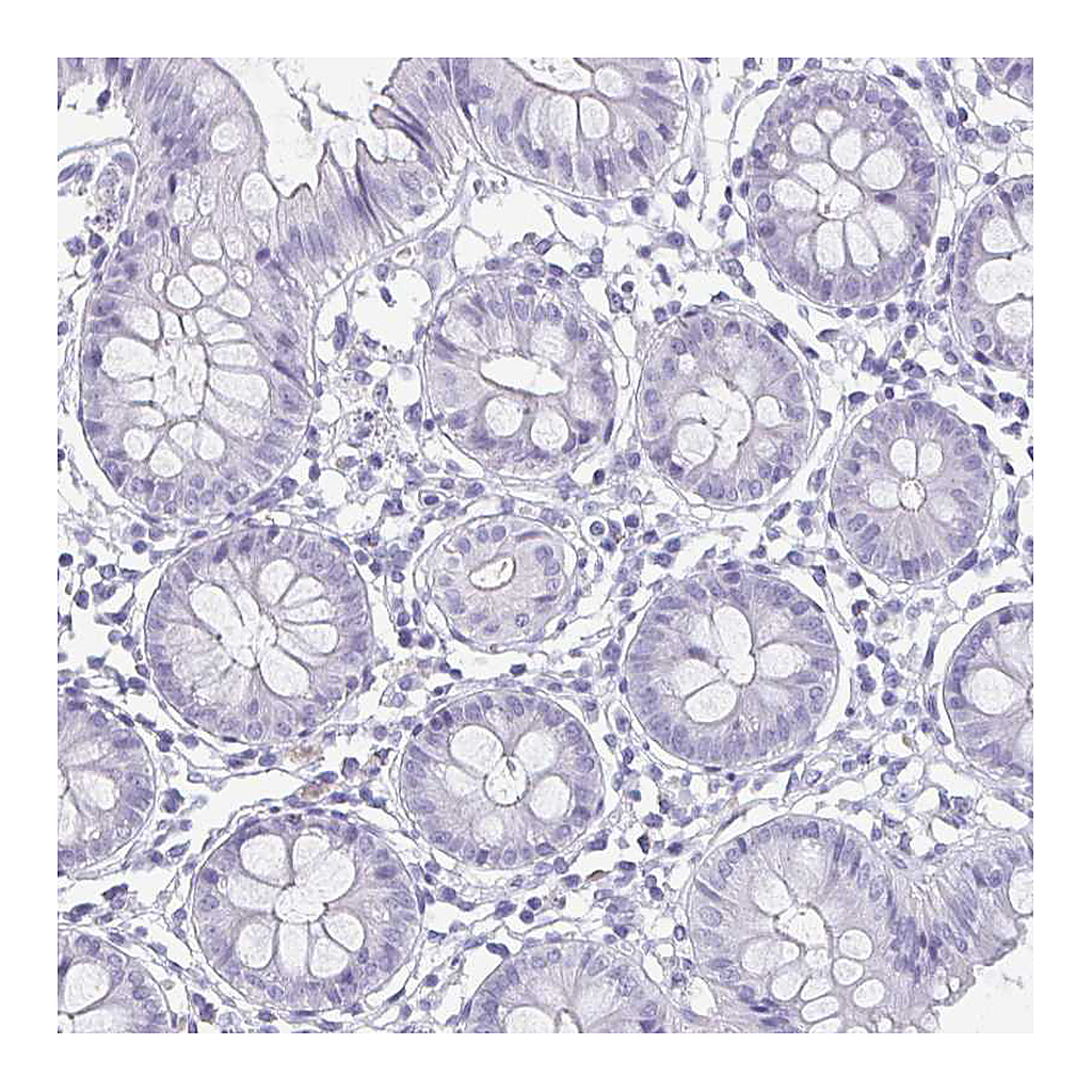 Atlas Antibodies Anti-GHRL Antibody