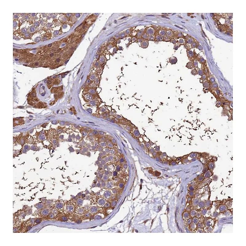 Atlas Antibodies Anti-GID4 Antibody