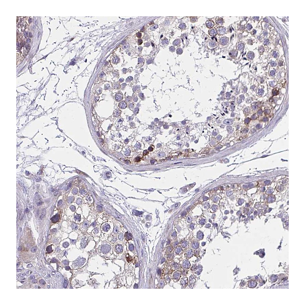 Atlas Antibodies Anti-GIGYF2 Antibody