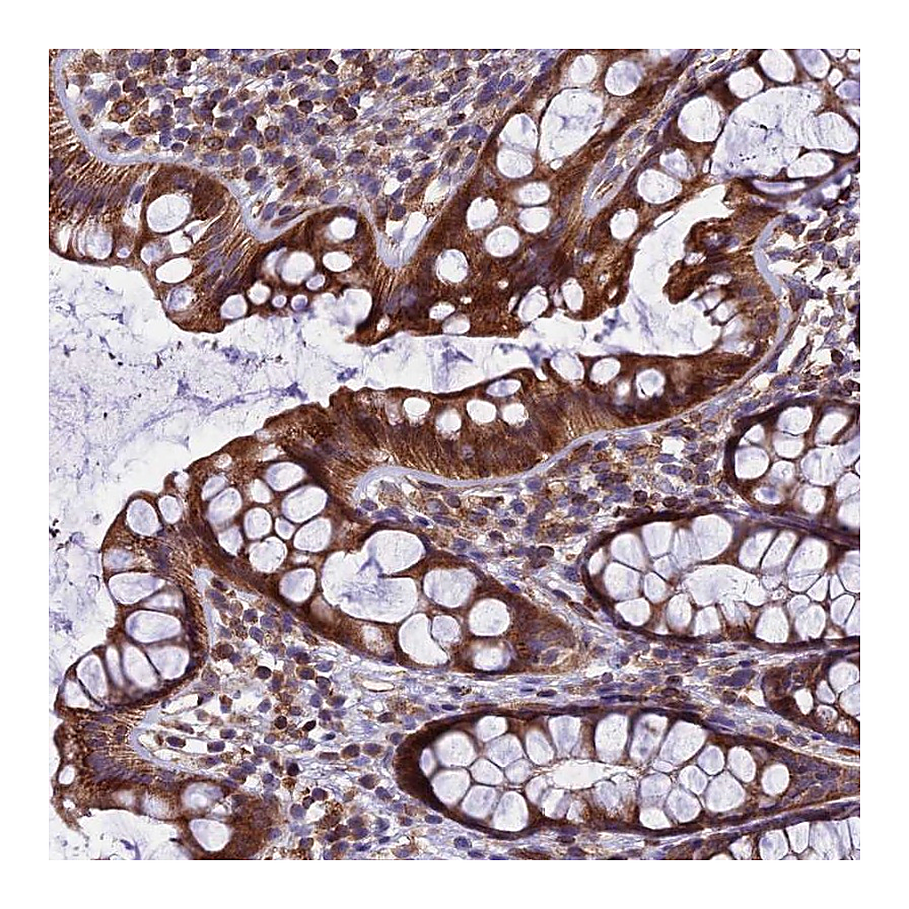 Atlas Antibodies Anti-GIMAP1 Antibody