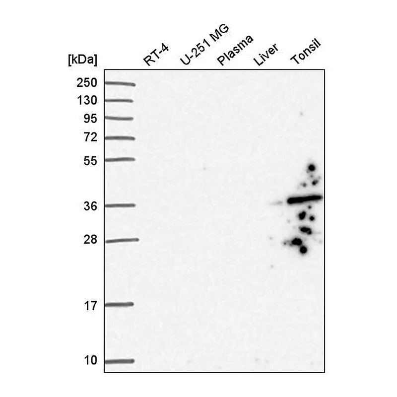 Atlas Antibodies Anti-GIMAP1 Antibody