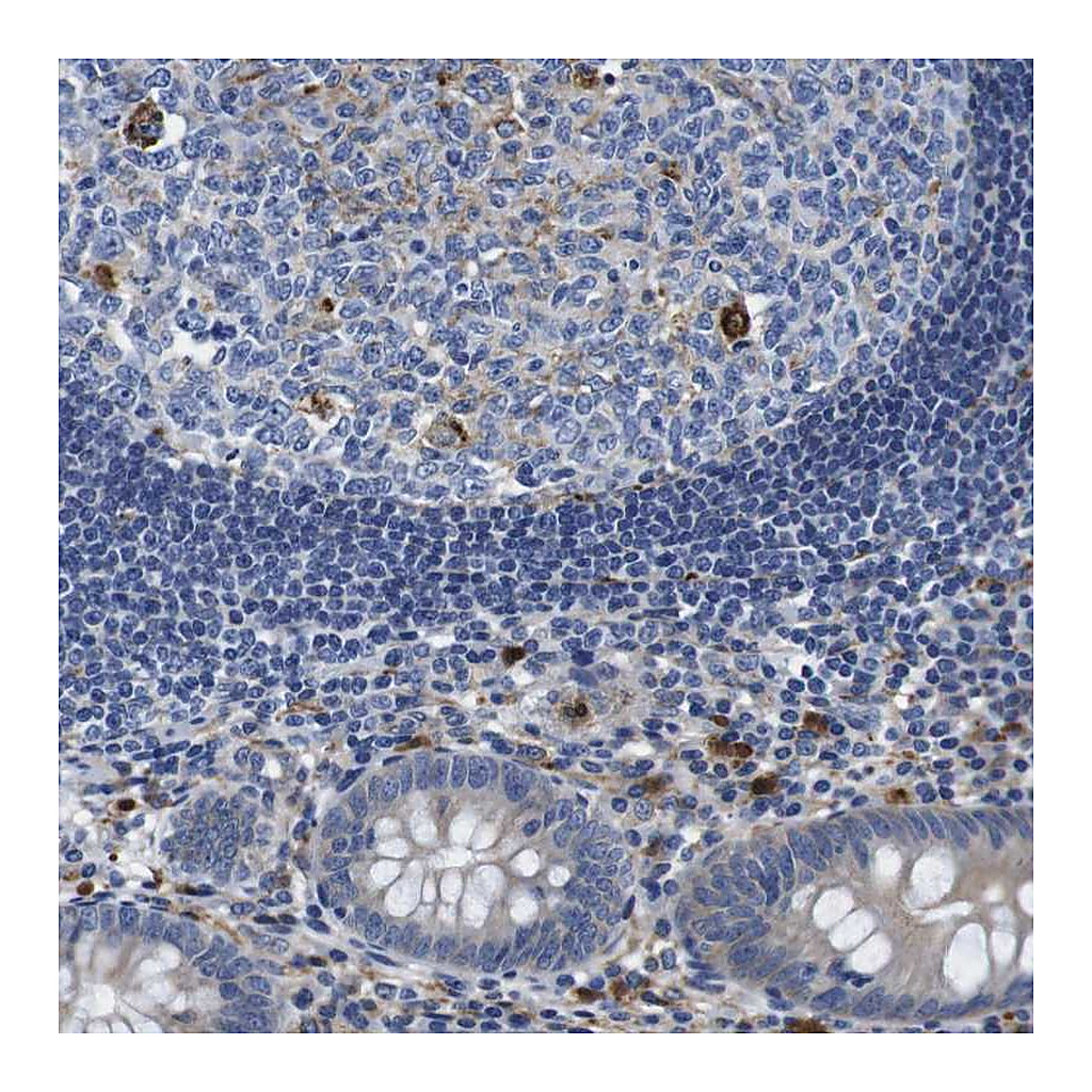 Atlas Antibodies Anti-GIMAP2 Antibody