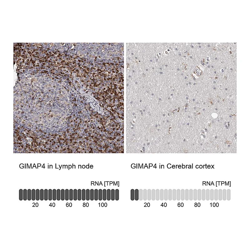 Atlas Antibodies Anti-GIMAP4 Antibody
