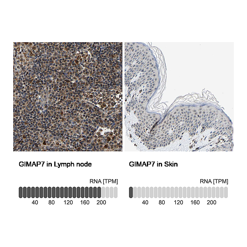 Atlas Antibodies Anti-GIMAP7 Antibody