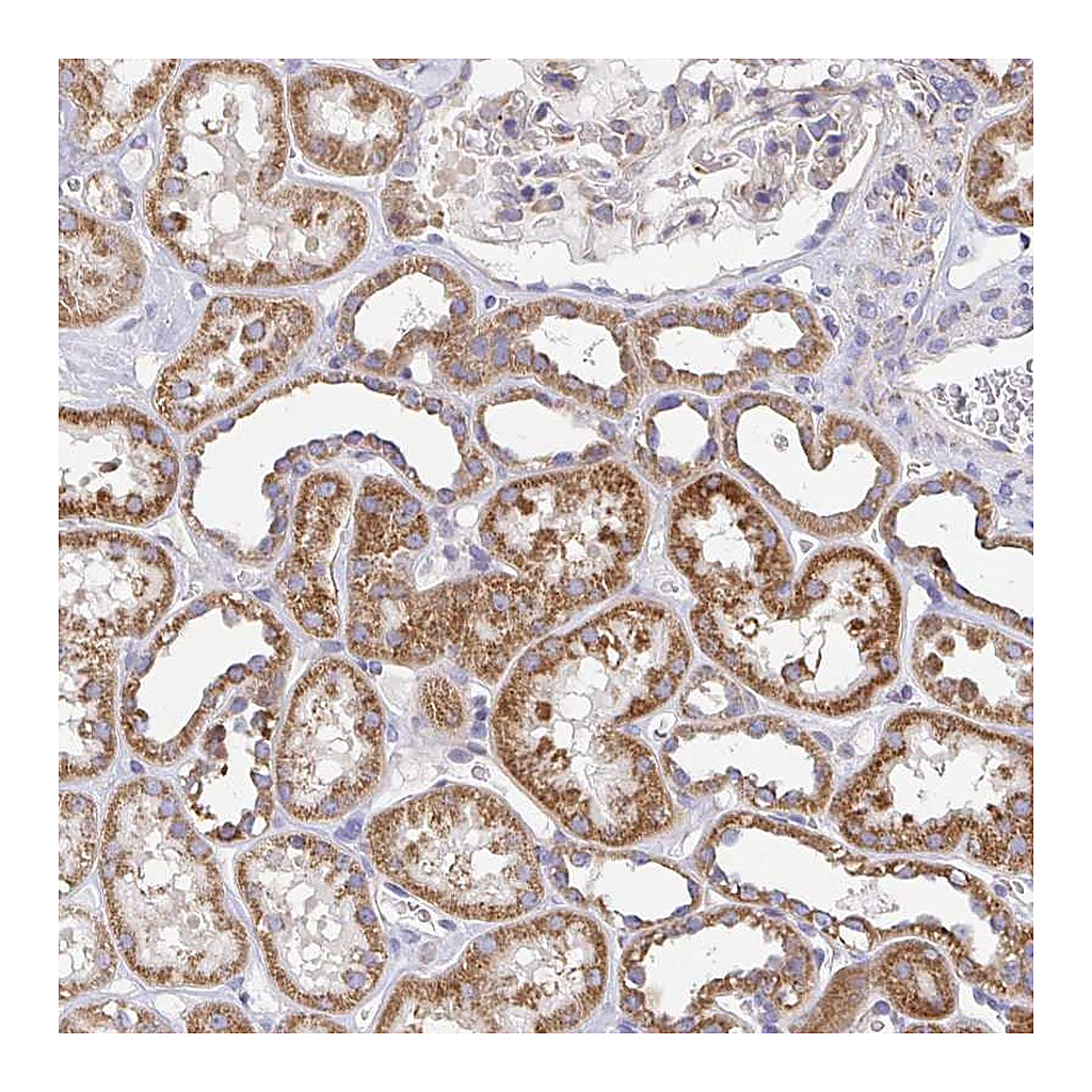 Atlas Antibodies Anti-GINM1 Antibody