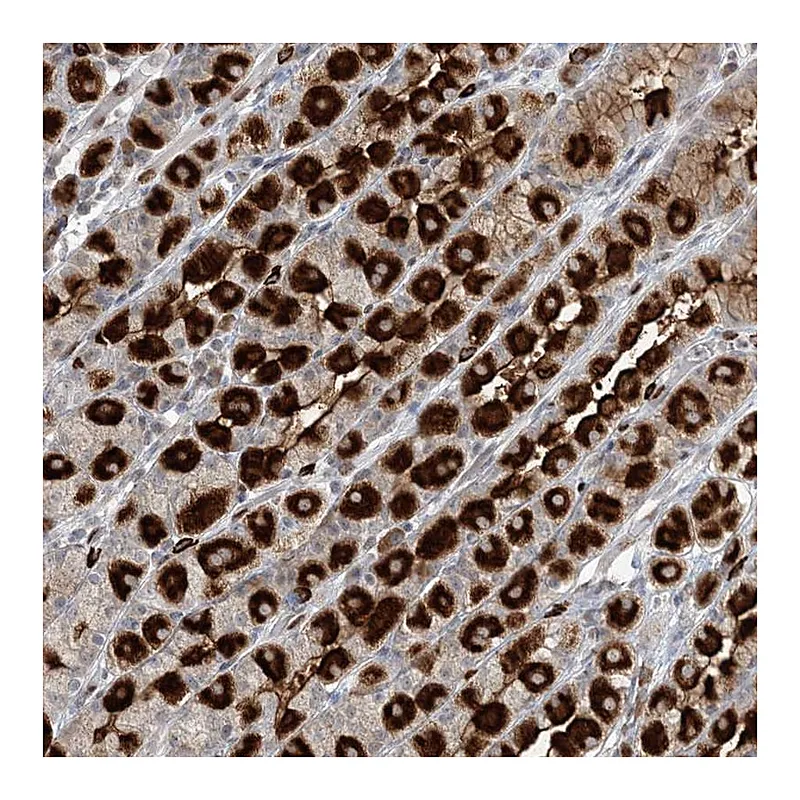 Atlas Antibodies Anti-GIN1 Antibody