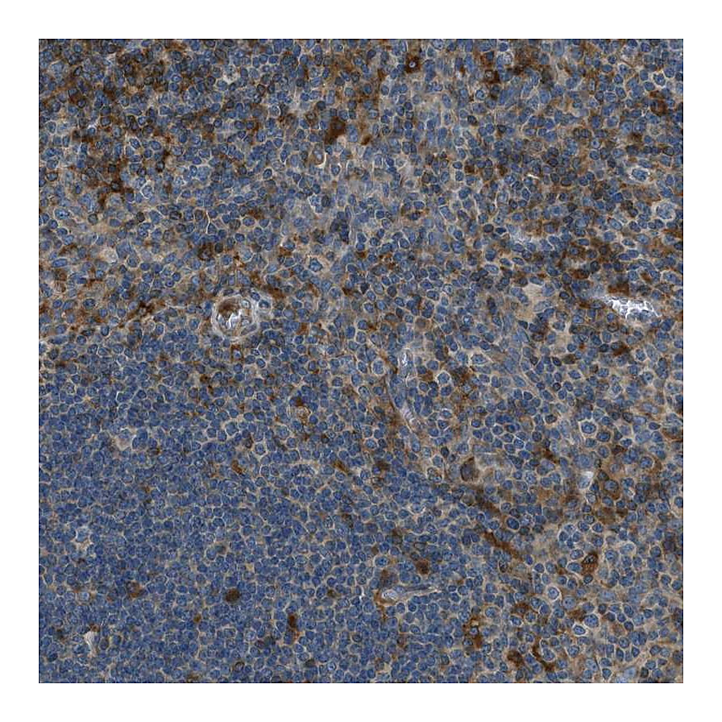 Atlas Antibodies Anti-GIMAP8 Antibody