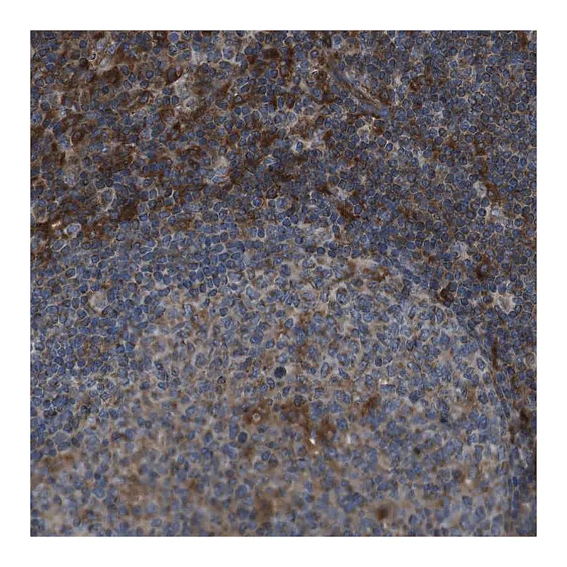 Atlas Antibodies Anti-GIMAP8 Antibody