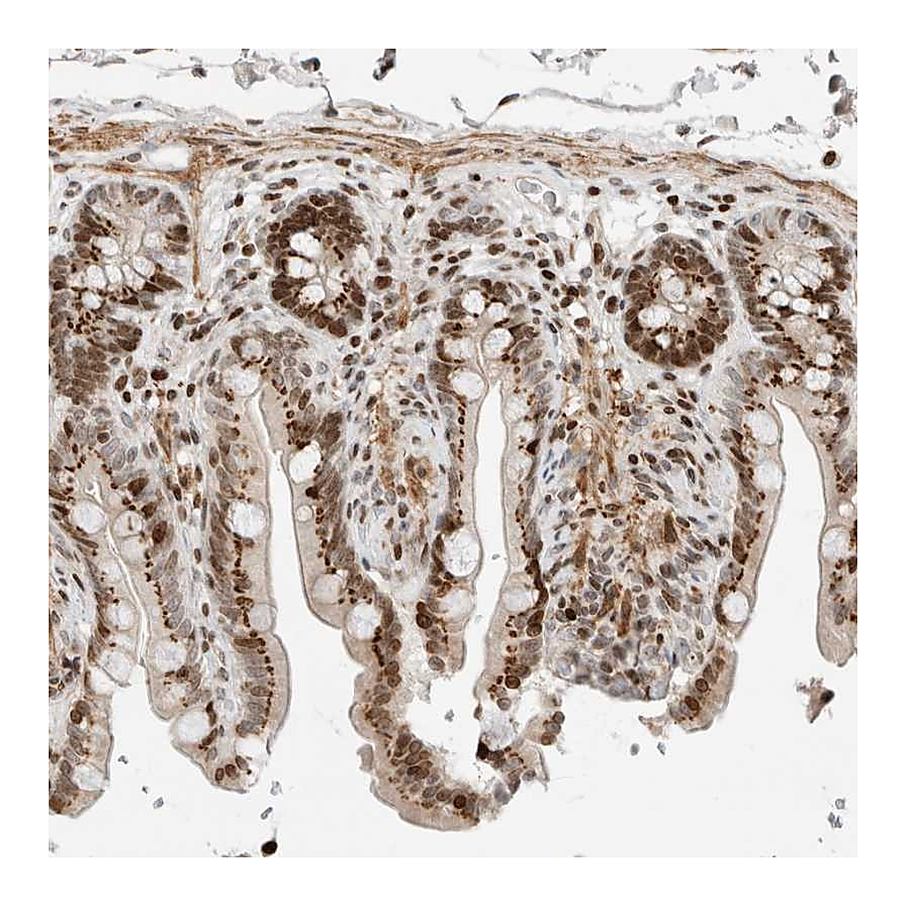 Atlas Antibodies Anti-GINS4 Antibody