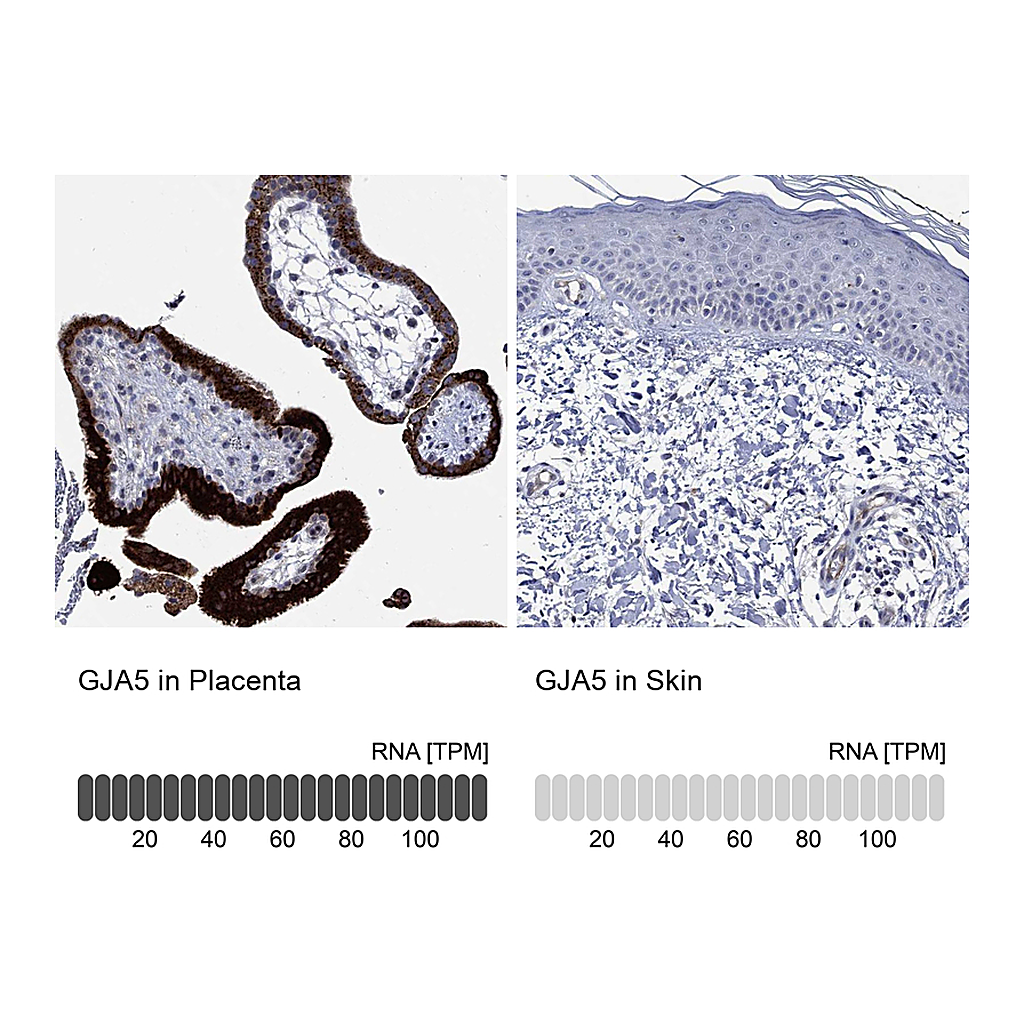Atlas Antibodies Anti-GJA5 Antibody