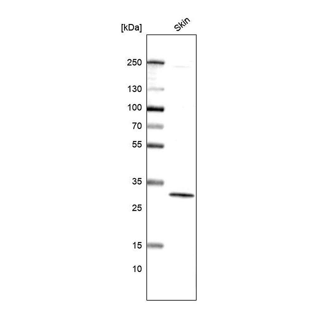 Atlas Antibodies Anti-GJB4 Antibody
