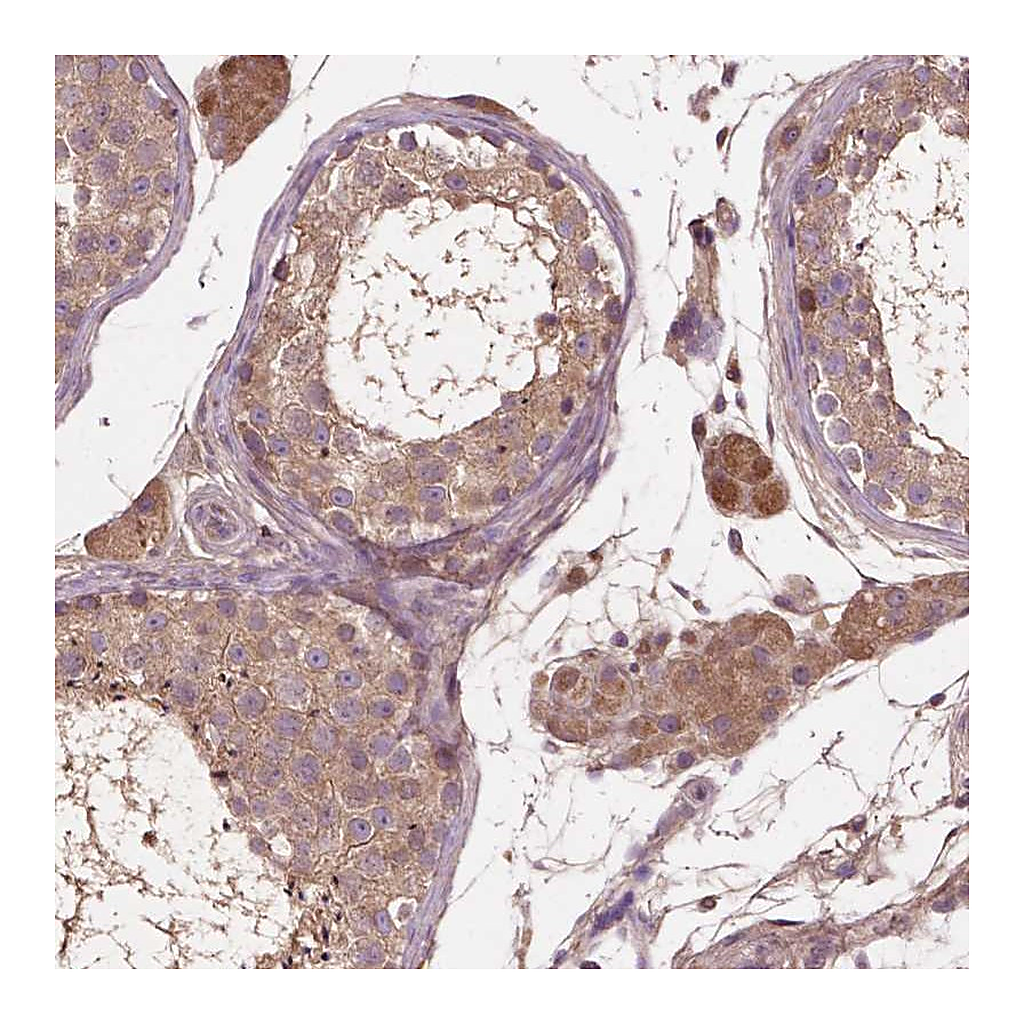 Atlas Antibodies Anti-GJA9 Antibody