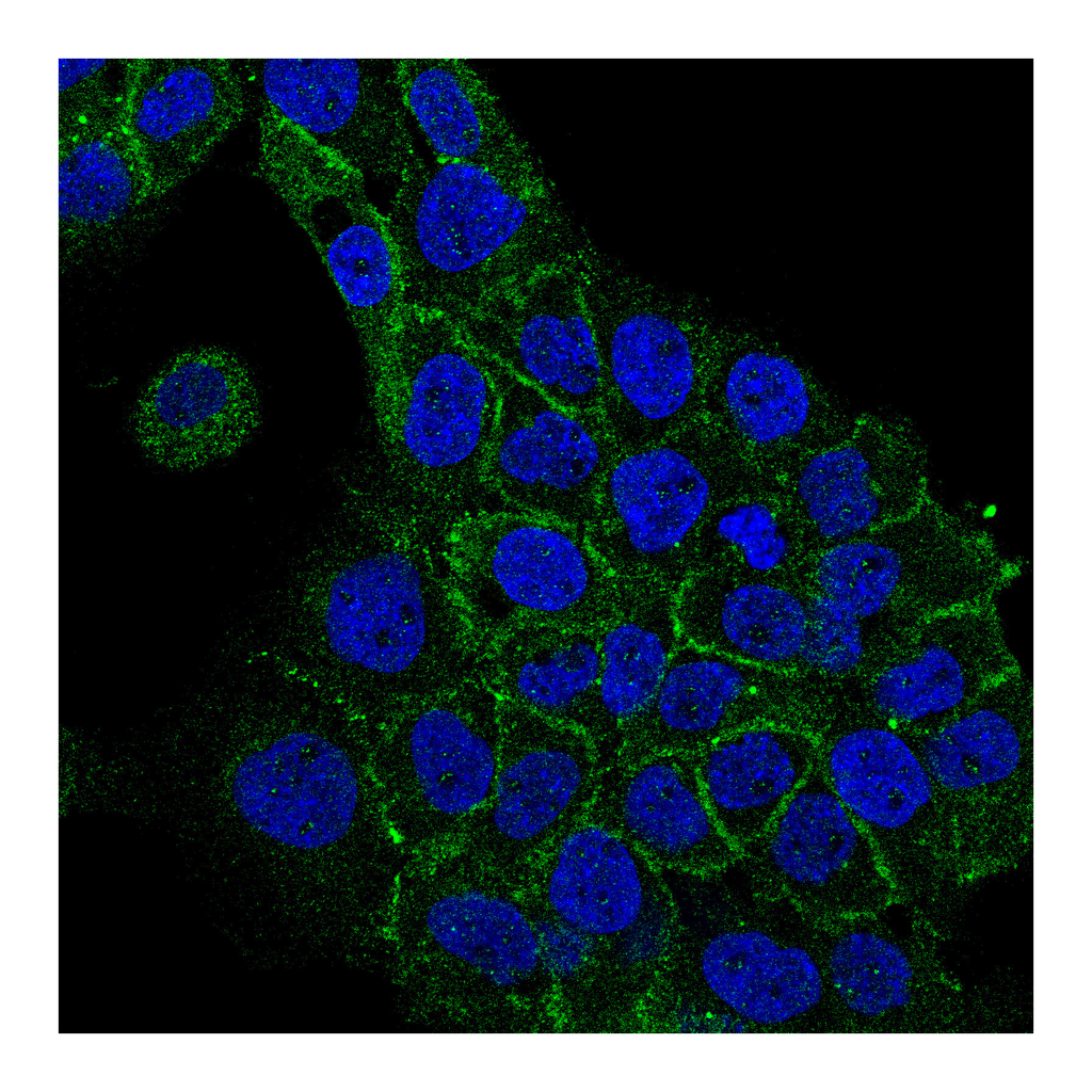 Atlas Antibodies Anti-GJB3 Antibody