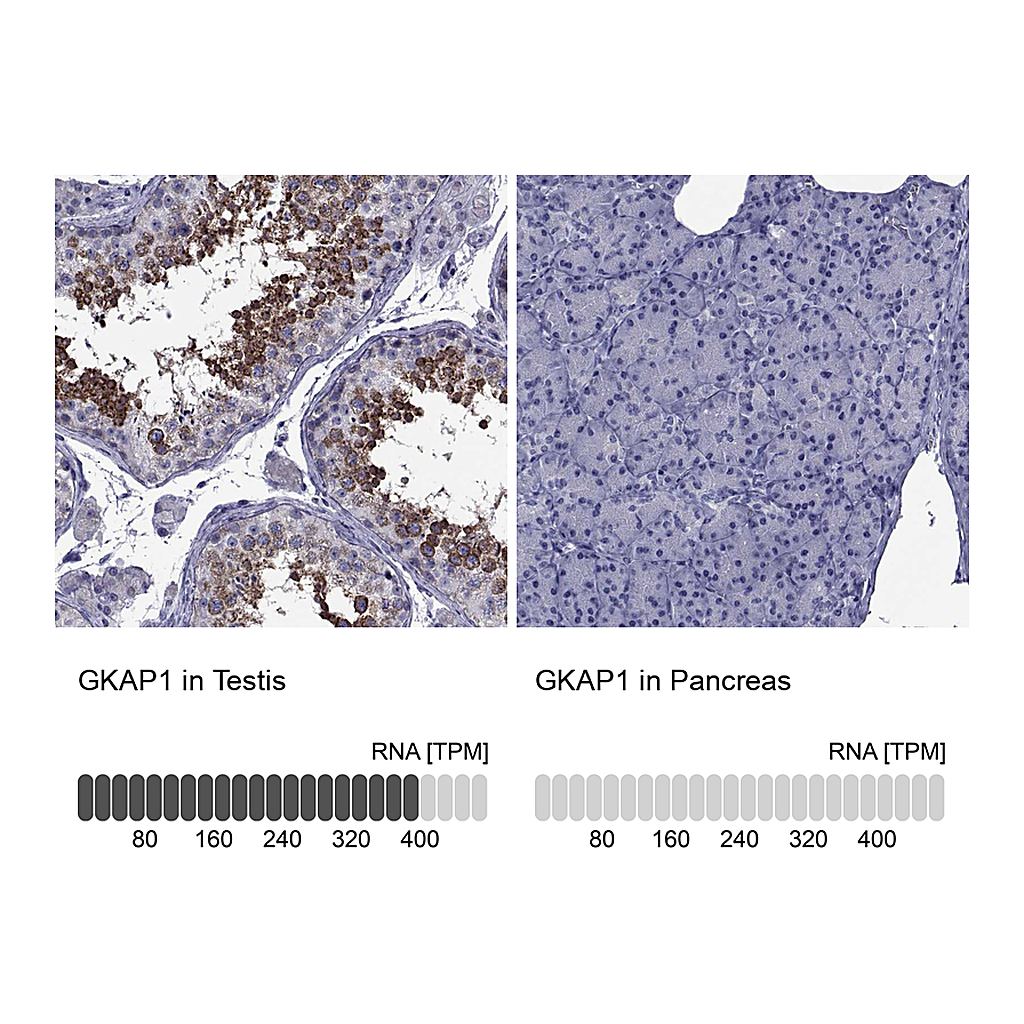 Atlas Antibodies Anti-GKAP1 Antibody