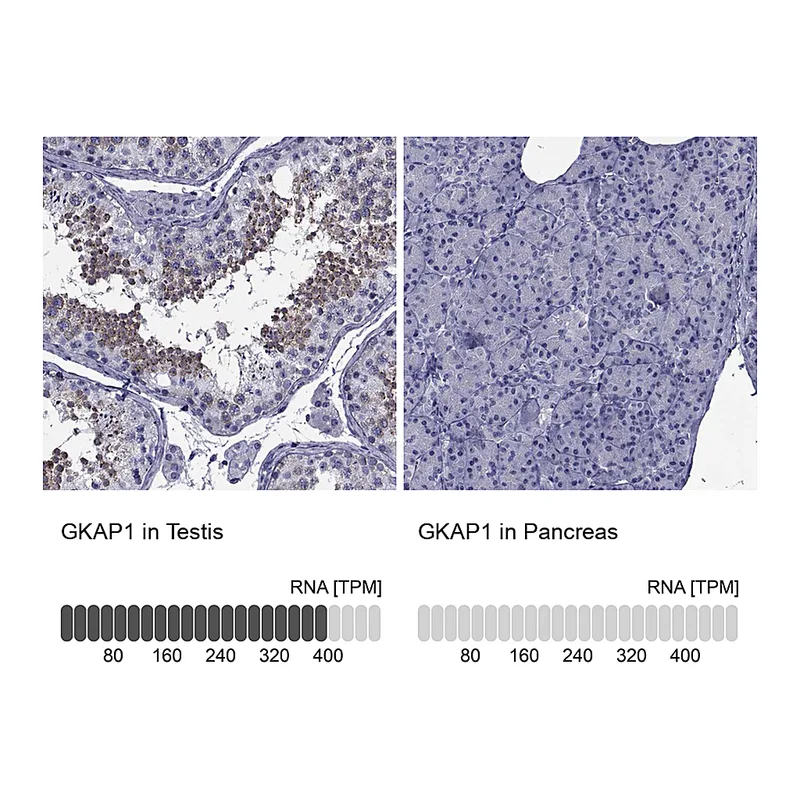 Atlas Antibodies Anti-GKAP1 Antibody