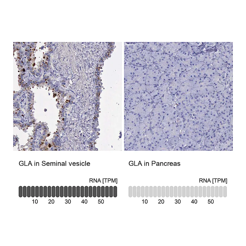 Atlas Antibodies Anti-GLA Antibody