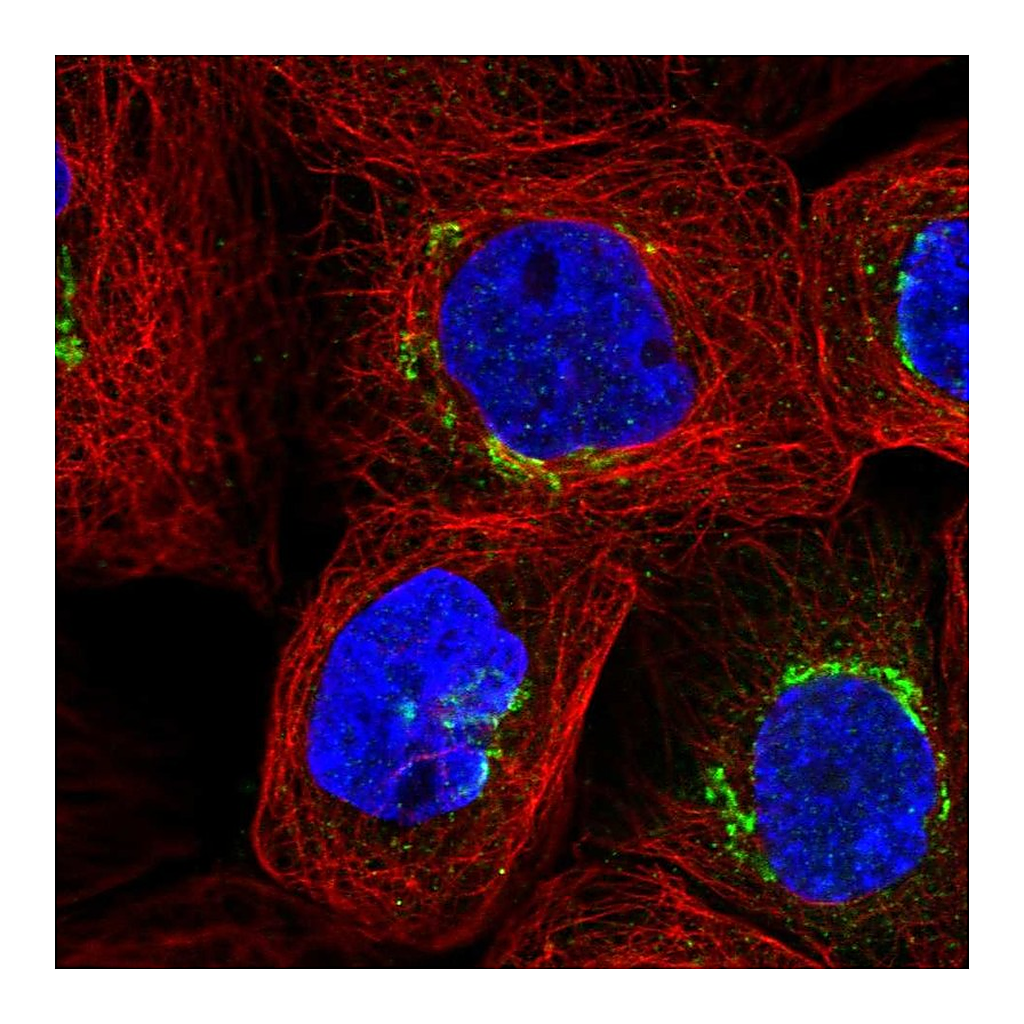 Atlas Antibodies Anti-GLB1 Antibody