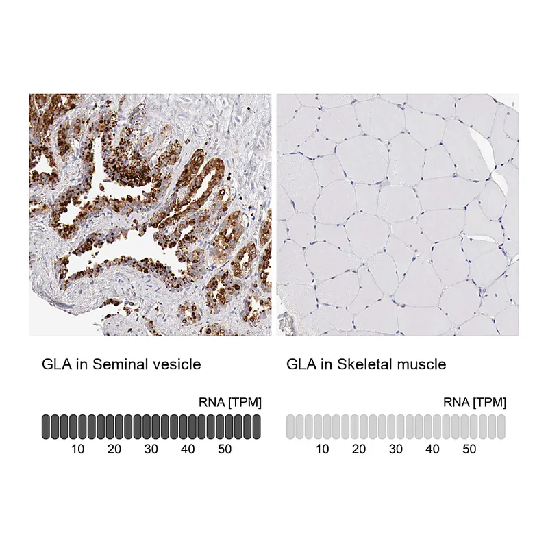 Atlas Antibodies Anti-GLA Antibody