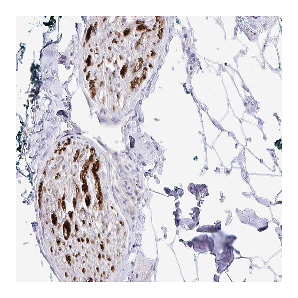 Atlas Antibodies Anti-GLDN Antibody