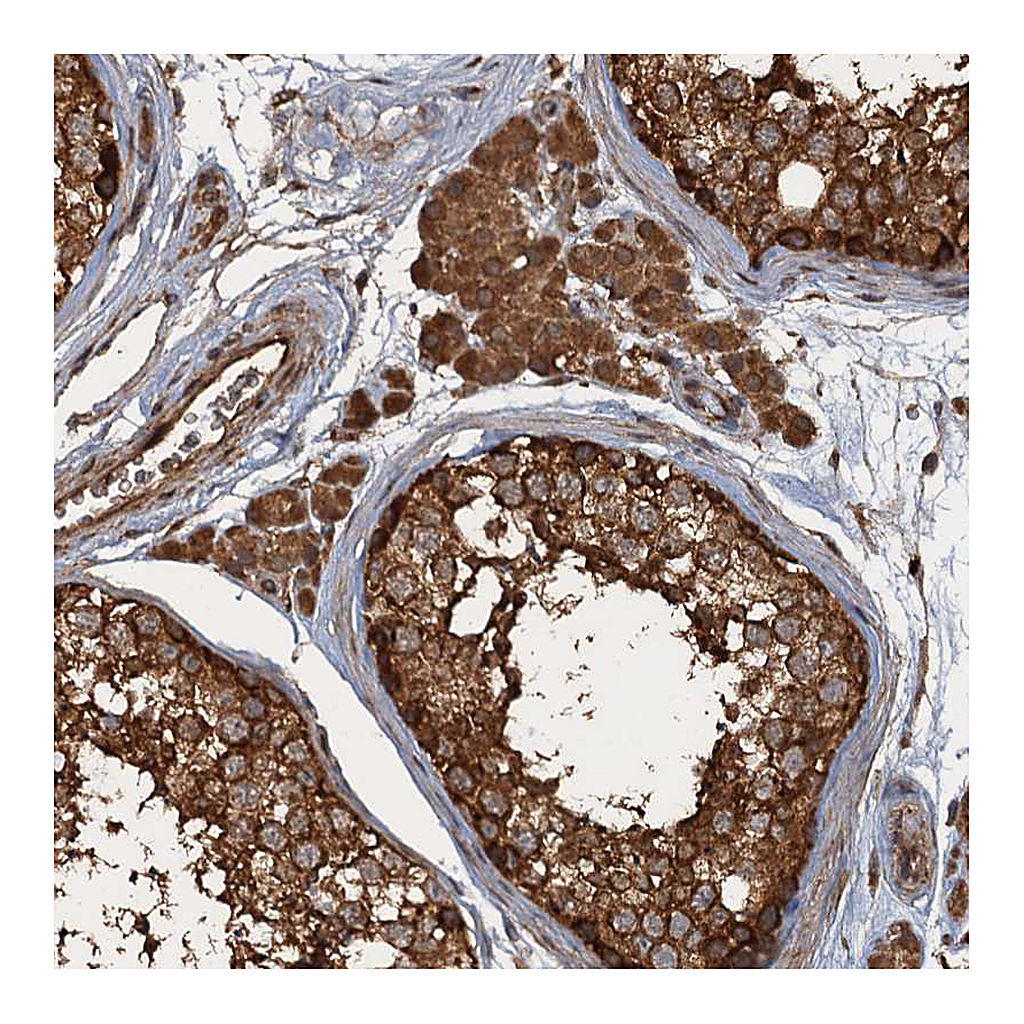 Atlas Antibodies Anti-GLE1 Antibody
