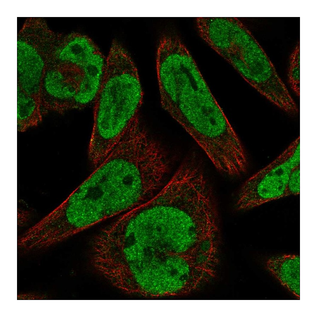Atlas Antibodies Anti-GLI1 Antibody